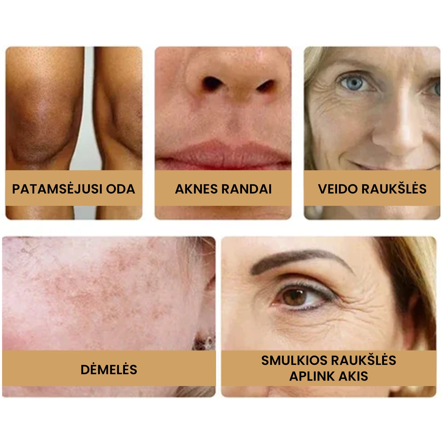 TurmaX™ ciberžolių veido serumas